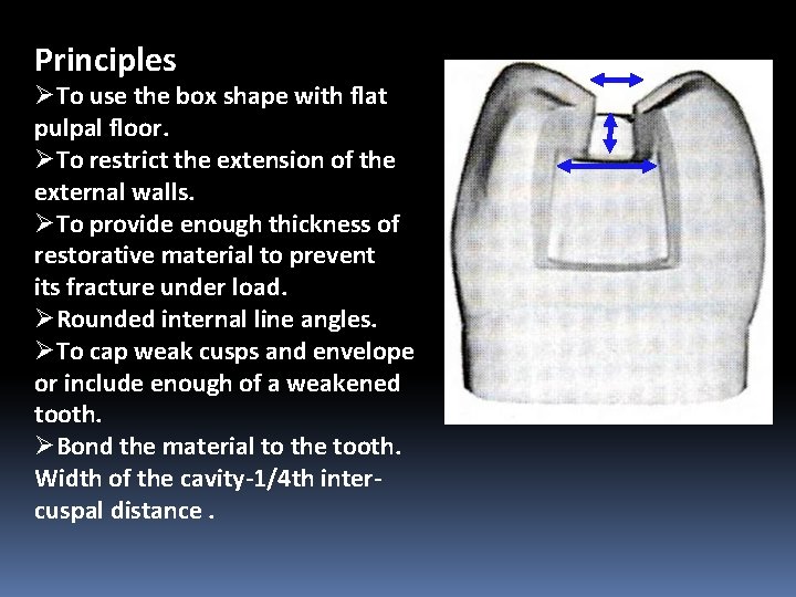 Principles ØTo use the box shape with flat pulpal floor. ØTo restrict the extension