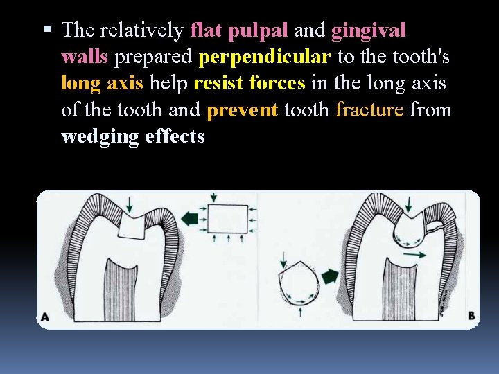  The relatively flat pulpal and gingival walls prepared perpendicular to the tooth's long