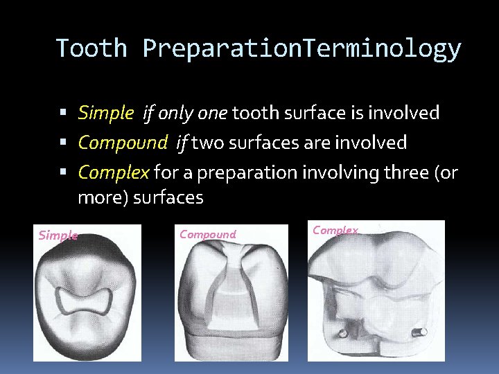 Tooth Preparation. Terminology Simple if only one tooth surface is involved Compound if two