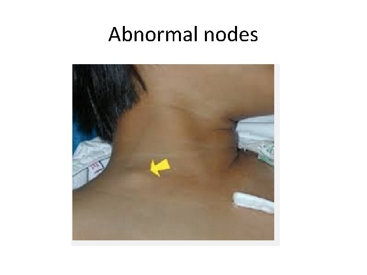 Abnormal nodes 