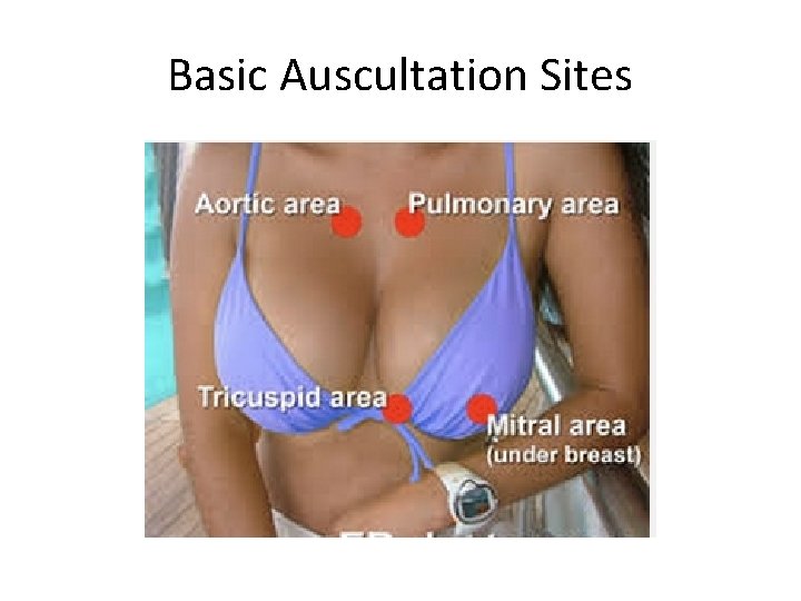 Basic Auscultation Sites 