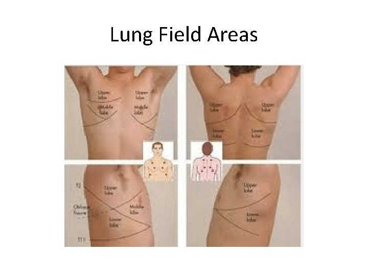 Lung Field Areas 