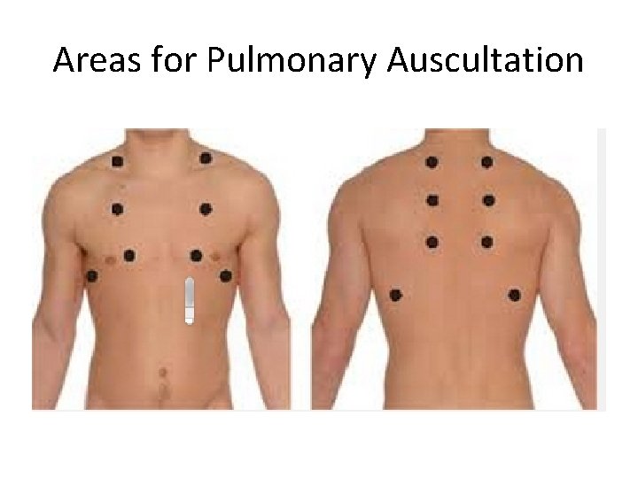 Areas for Pulmonary Auscultation 