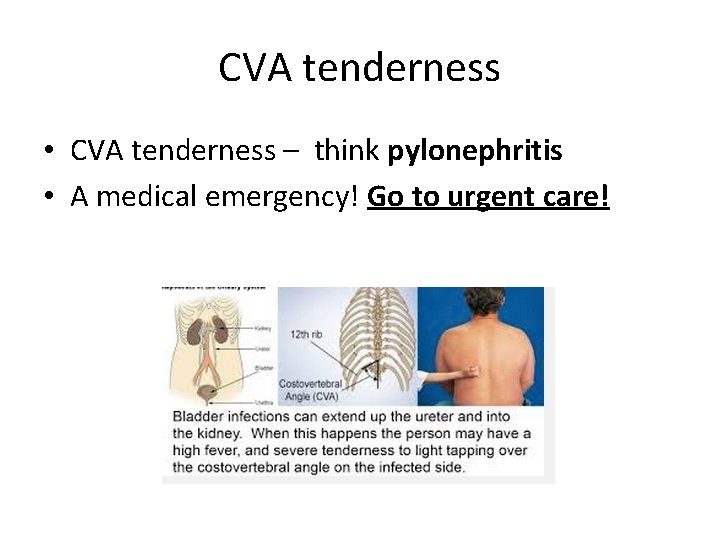 CVA tenderness • CVA tenderness – think pylonephritis • A medical emergency! Go to