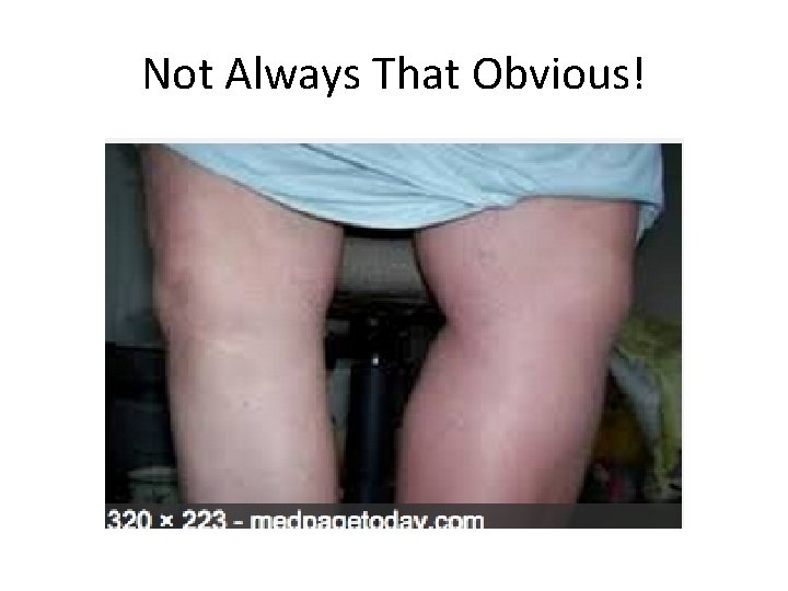 Not Always That Obvious! 