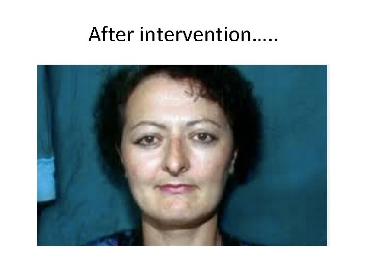 After intervention…. . 