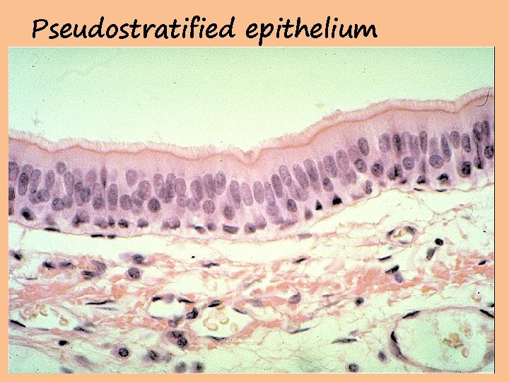 Pseudostratified epithelium 