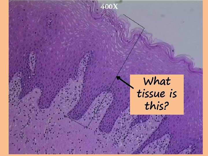 What tissue is this? 