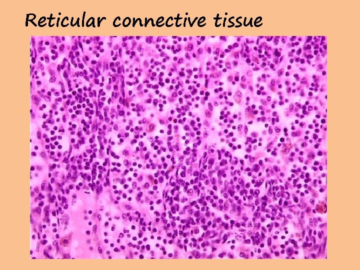 Reticular connective tissue 