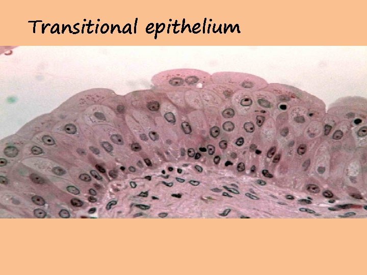 Transitional epithelium 