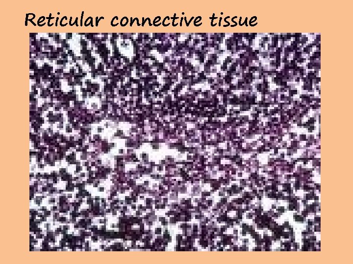 Reticular connective tissue 