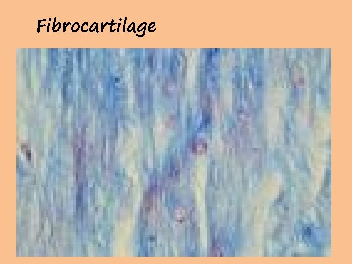 Fibrocartilage 