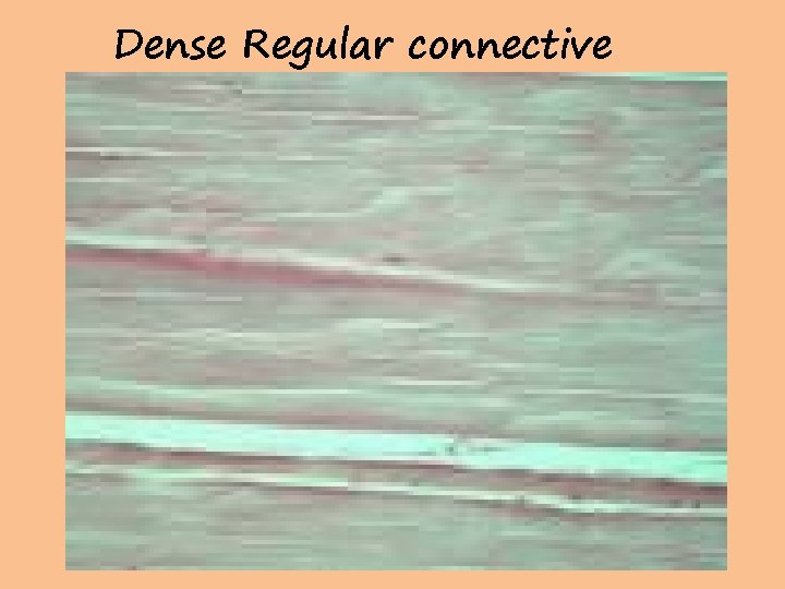 Dense Regular connective 