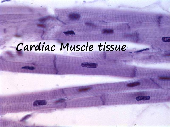 Cardiac Muscle tissue 