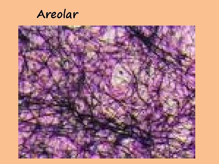 Areolar 