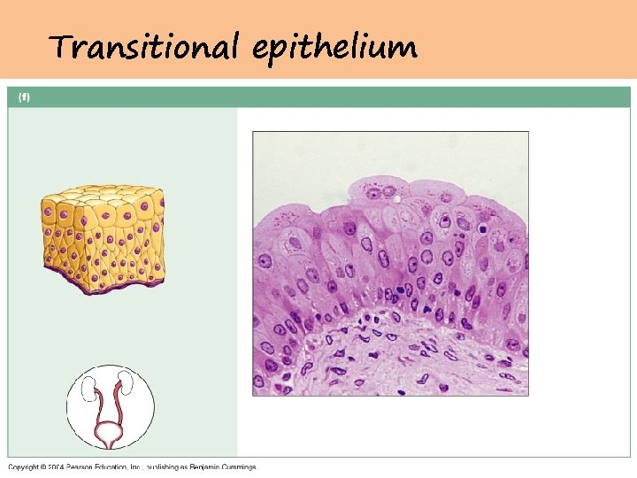 Transitional epithelium 