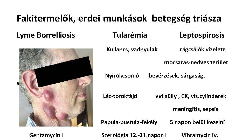 Fakitermelők, erdei munkások betegség triásza Lyme Borrelliosis Tularémia Leptospirosis Kullancs, vadnyulak rágcsálók vizelete mocsaras-nedves