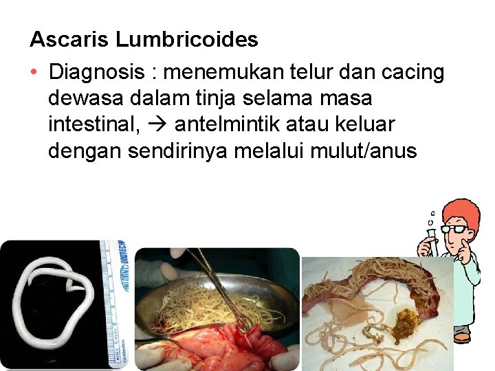 Ascaris Lumbricoides • Diagnosis : menemukan telur dan cacing dewasa dalam tinja selama masa