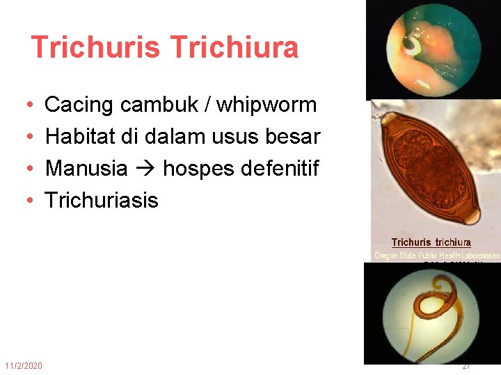 Trichuris Trichiura • • 11/2/2020 Cacing cambuk / whipworm Habitat di dalam usus besar