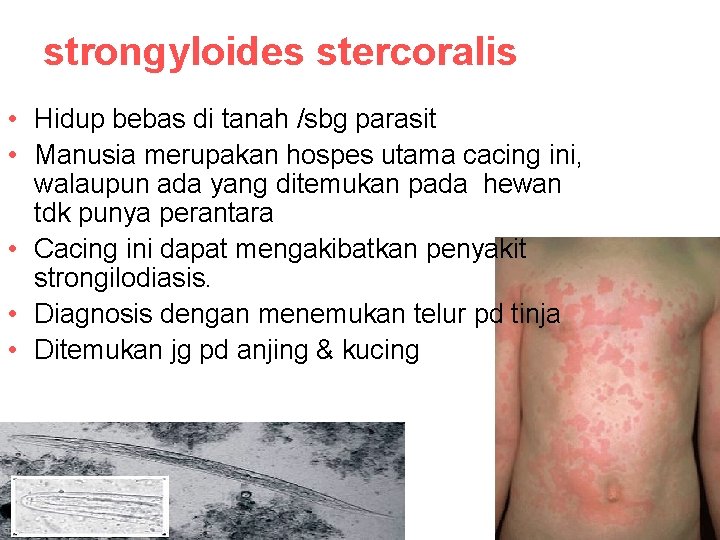 strongyloides stercoralis • Hidup bebas di tanah /sbg parasit • Manusia merupakan hospes utama