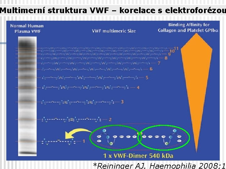 Multimerní struktura VWF – korelace s elektroforézou *Reininger AJ. Haemophilia 2008; 14 