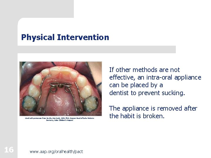 Physical Intervention If other methods are not effective, an intra-oral appliance can be placed