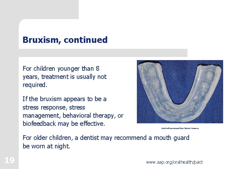 Bruxism, continued For children younger than 8 years, treatment is usually not required. If