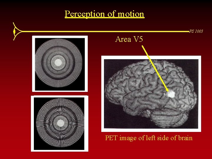 Perception of motion PS 1003 Area V 5 PET image of left side of