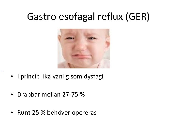 Gastro esofagal reflux (GER) • I princip lika vanlig som dysfagi • Drabbar mellan