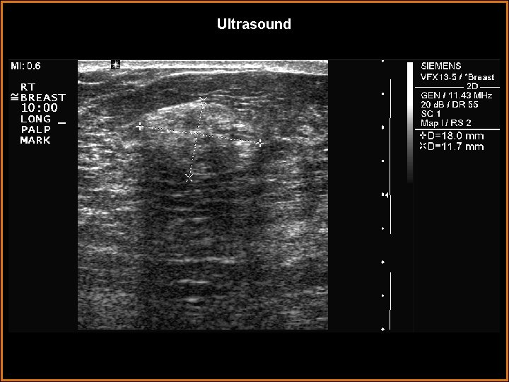 Ultrasound 