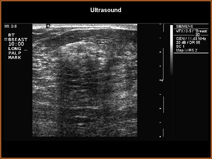 Ultrasound 