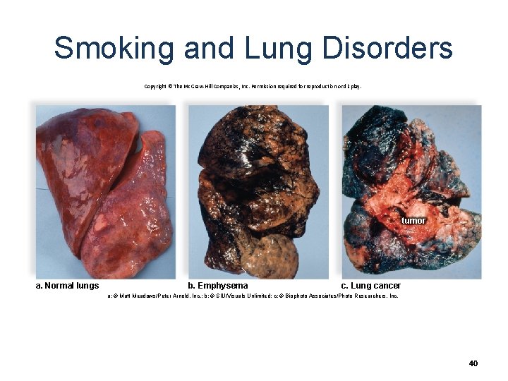 Smoking and Lung Disorders Copyright © The Mc. Graw-Hill Companies, Inc. Permission required for