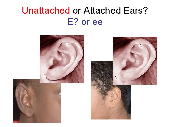 Unattached or Attached Ears? E? or ee 