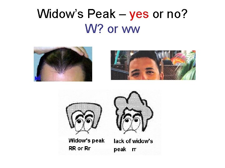 Widow’s Peak – yes or no? W? or ww 