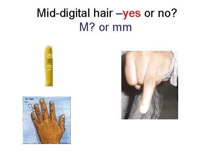 Mid-digital hair –yes or no? M? or mm 