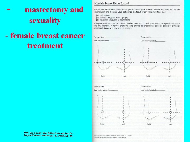 - mastectomy and sexuality - female breast cancer treatment From: Our Sexuality, Third Edition,