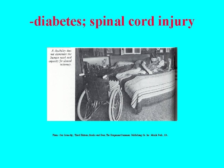 -diabetes; spinal cord injury From: Our Sexuality, Third Edition, Crooks and Baur, The Benjamin/Cummins
