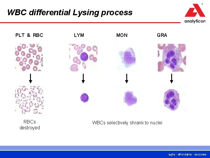 WBC differential Lysing process PLT & RBCs destroyed LYM MON GRA WBCs selectively shrank