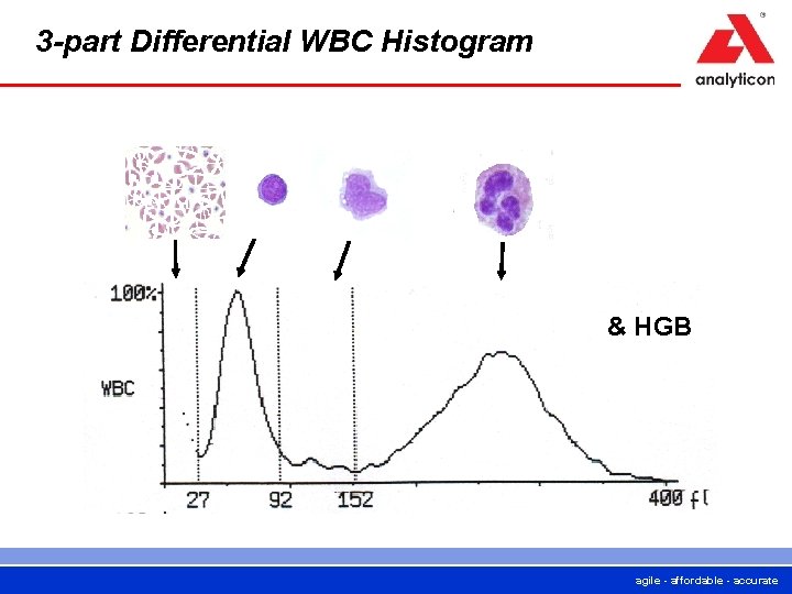 3 -part Differential WBC Histogram & HGB agile - affordable - accurate 