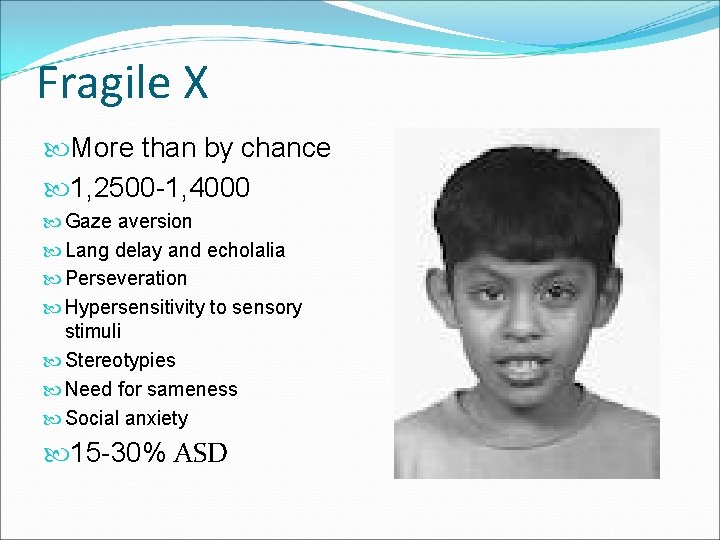 Fragile X More than by chance 1, 2500 -1, 4000 Gaze aversion Lang delay