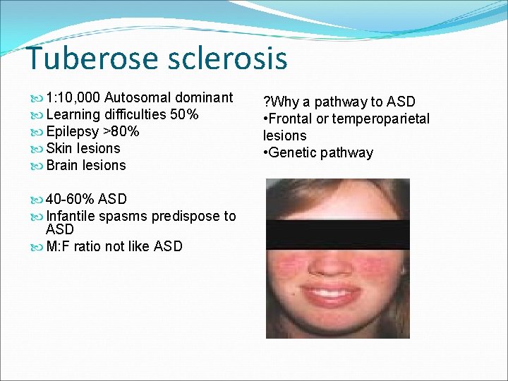 Tuberose sclerosis 1: 10, 000 Autosomal dominant Learning difficulties 50% Epilepsy >80% Skin lesions