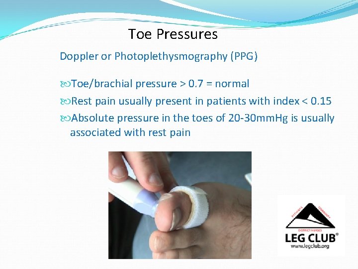 Toe Pressures Doppler or Photoplethysmography (PPG) Toe/brachial pressure > 0. 7 = normal Rest