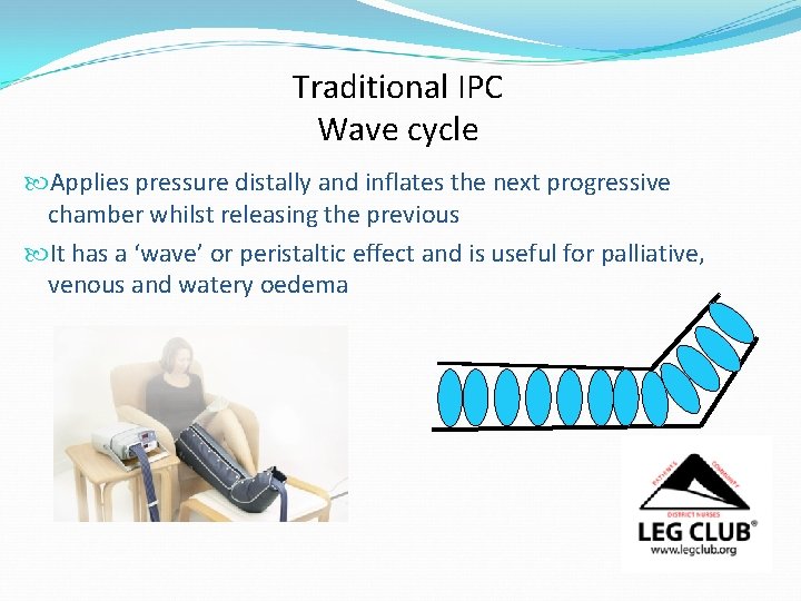 Traditional IPC Wave cycle Applies pressure distally and inflates the next progressive chamber whilst