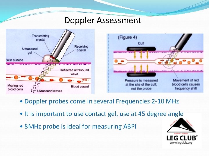 Doppler Assessment • Doppler probes come in several Frequencies 2 -10 MHz • It