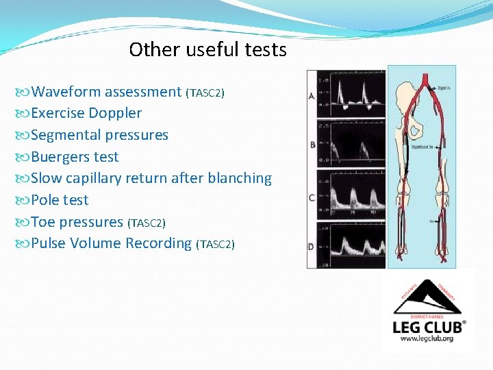 Other useful tests Waveform assessment (TASC 2) Exercise Doppler Segmental pressures Buergers test Slow