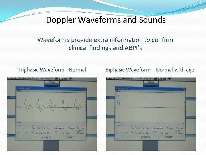 Doppler Waveforms and Sounds Waveforms provide extra information to confirm clinical findings and ABPI’s