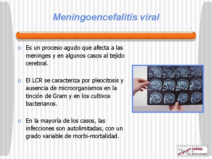 Meningoencefalitis viral o Es un proceso agudo que afecta a las meninges y en