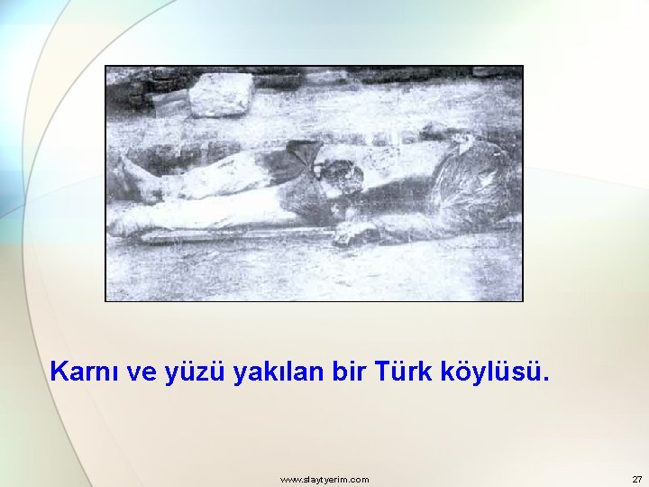Karnı ve yüzü yakılan bir Türk köylüsü. www. slaytyerim. com 27 