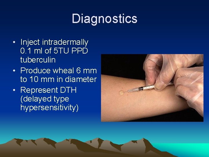 Diagnostics • Inject intradermally 0. 1 ml of 5 TU PPD tuberculin • Produce