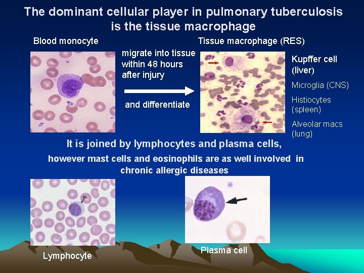 The dominant cellular player in pulmonary tuberculosis is the tissue macrophage Blood monocyte Tissue